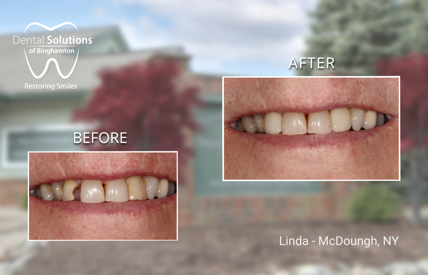 Restorative Dental Care